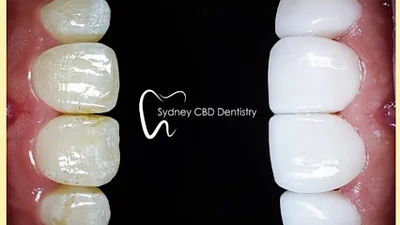 Sydney CBD Dentistry